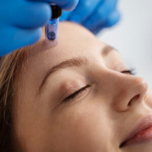tratamiento con exoxomas en nuestra clínica